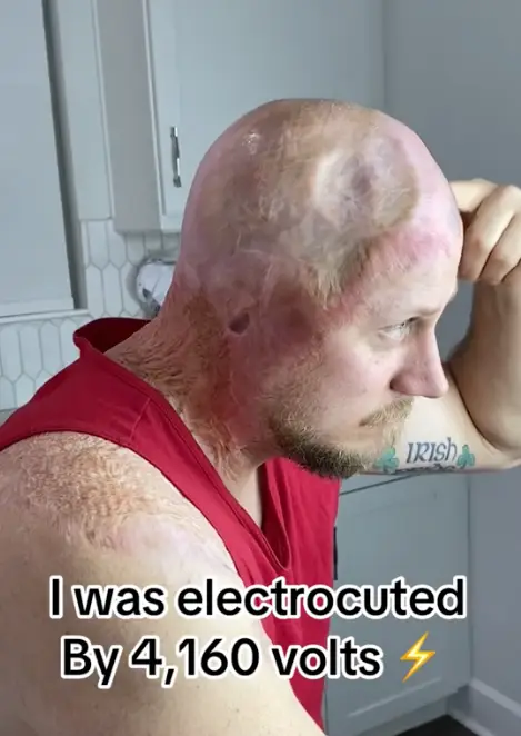 John Pendleton said he 'died twice' when he was electrocuted (TikTok/@johnarcingaheadapparel)