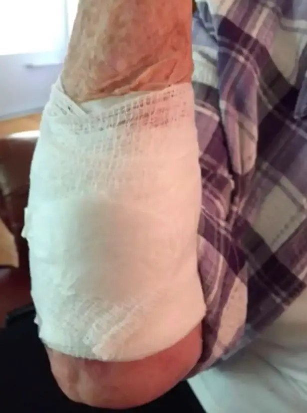 Amazingly, the pensioner walked away from the encounter with only a scratch on her arm.