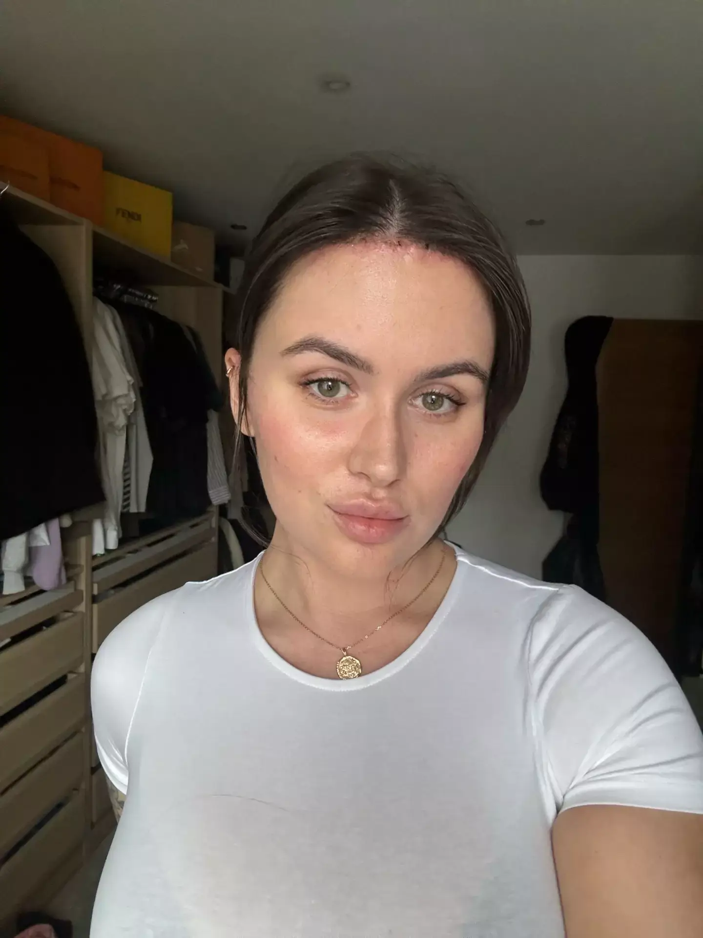 And here she is after.