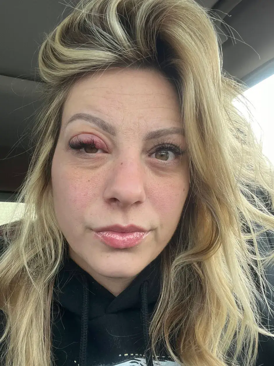 Raylee Reinhart has warned against taking the substance (Raylee Reinhart)