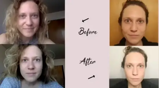 Sara's collagen 'before and after' pictures (YouTube/Sara Anderson)
