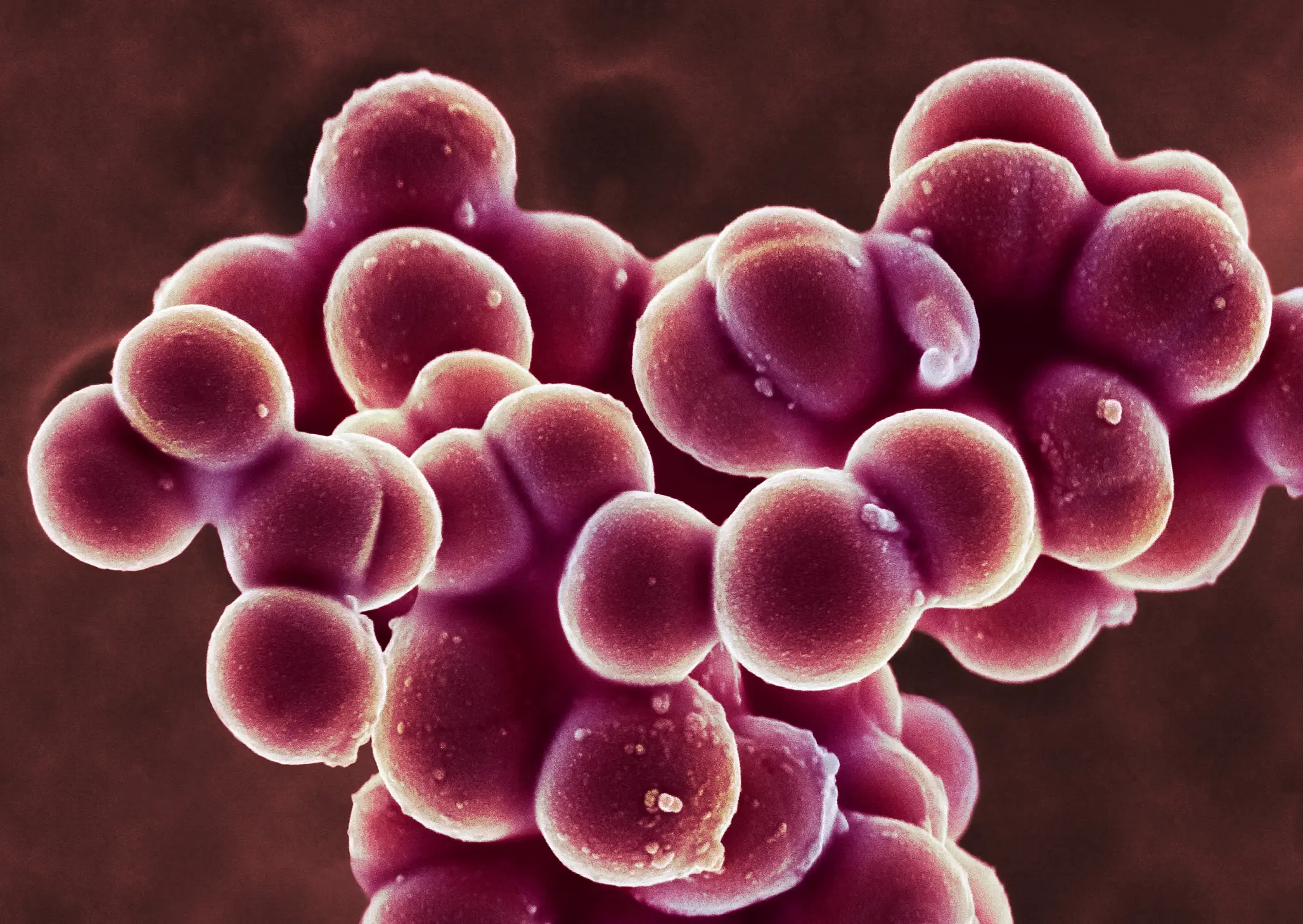 TSS is caused by bacteria that builds up on menstrual products or on skin wounds (Getty Stock)