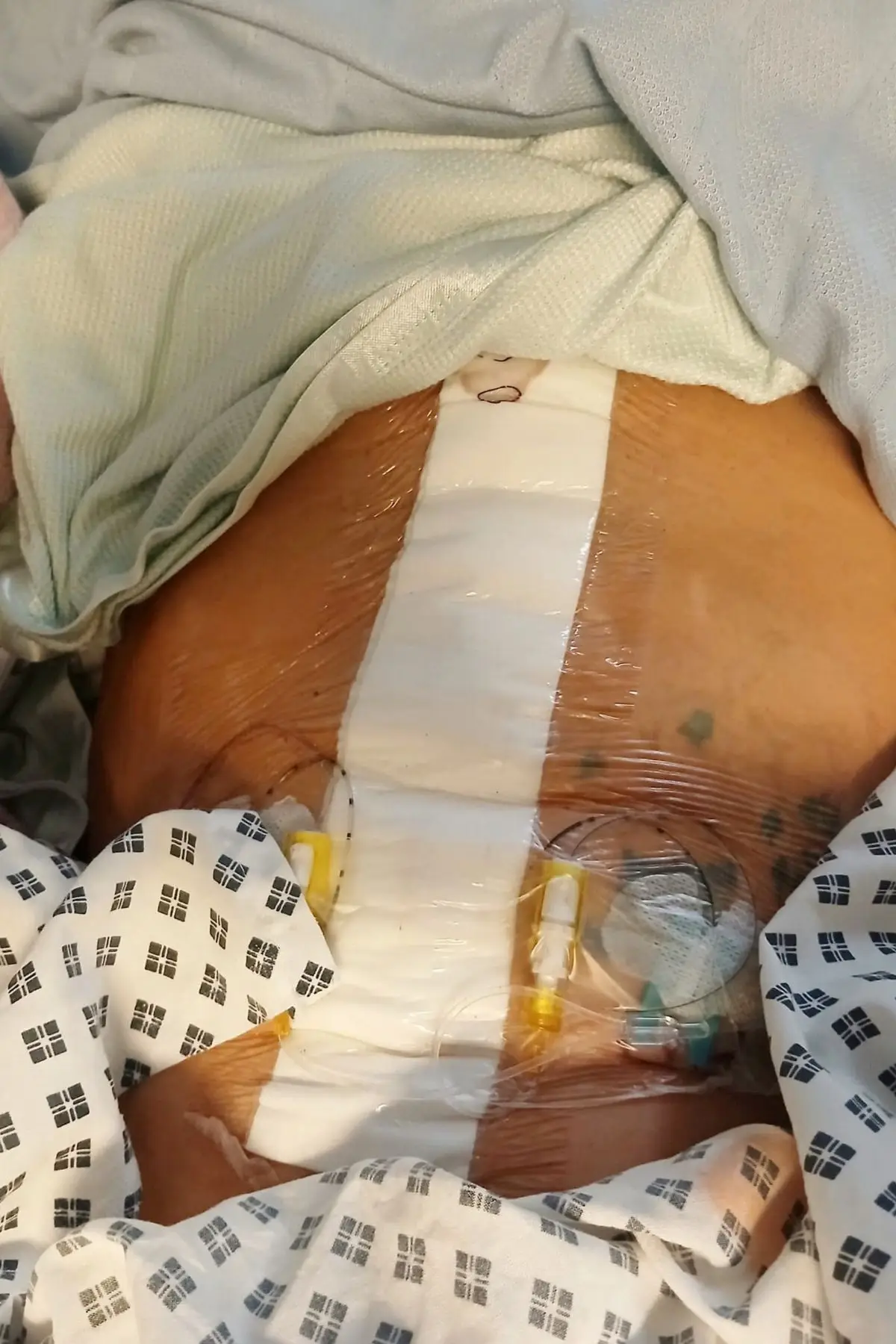 The 31-year-old was informed she could no longer naturally carry children (SWNS)