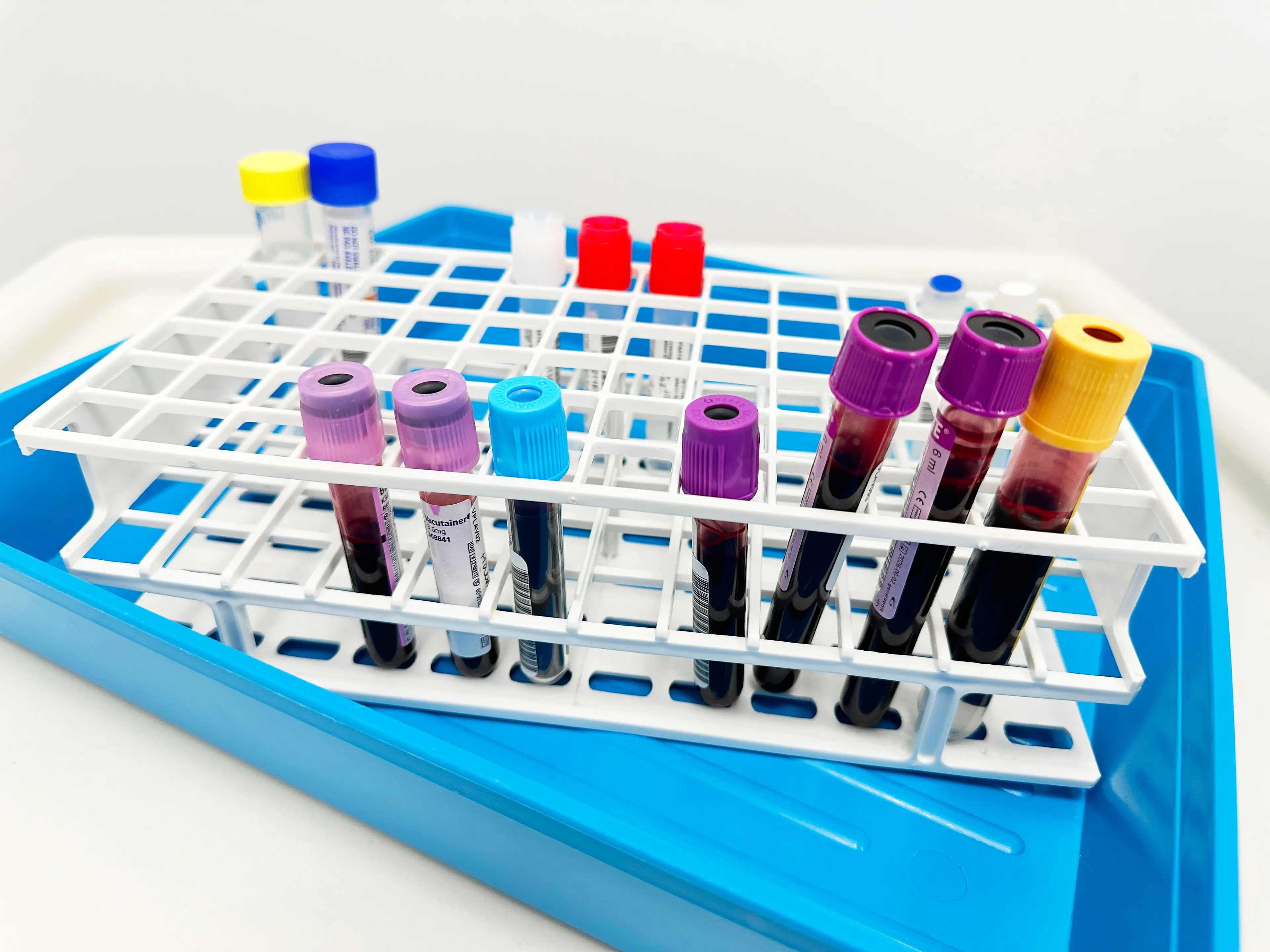 The new treatment could offer a 'one and done' solution to high LDL (Getty)