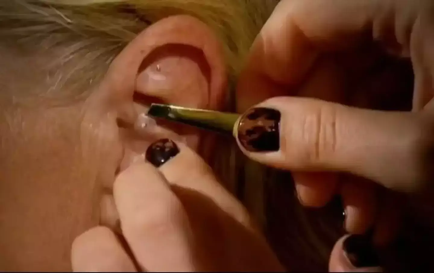 The entrepreneur's 'ear seeds' sparked quite the controversy (BBC)