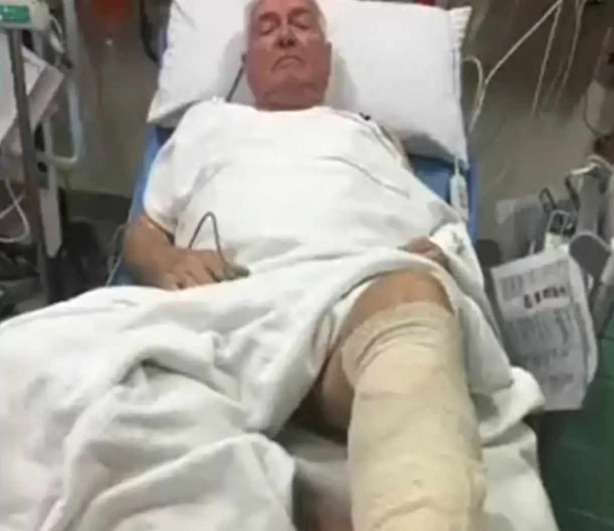 He sustained a deep cut to his leg.