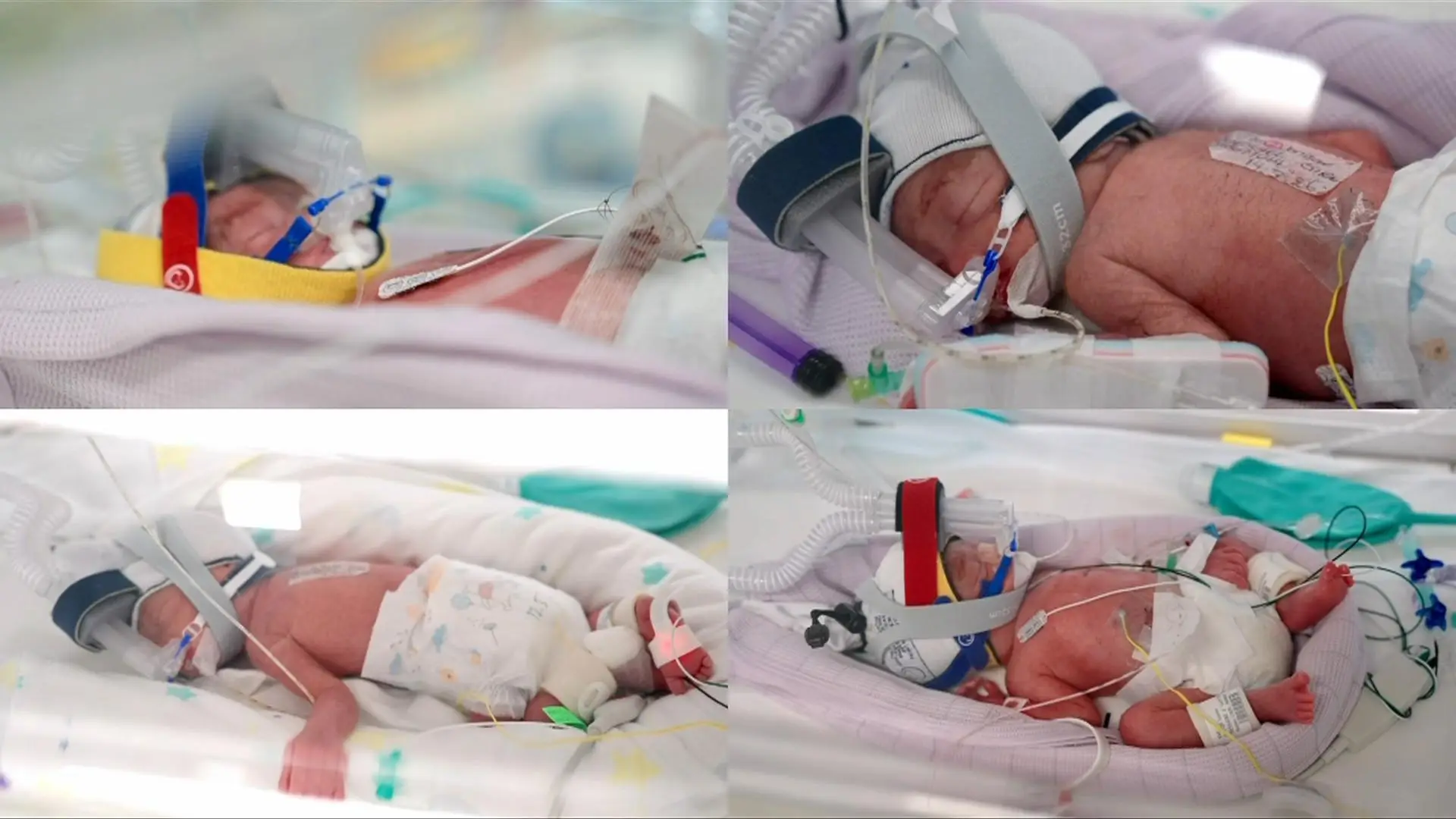 The miracle babies all weighed within 100g of each other (RWBH)