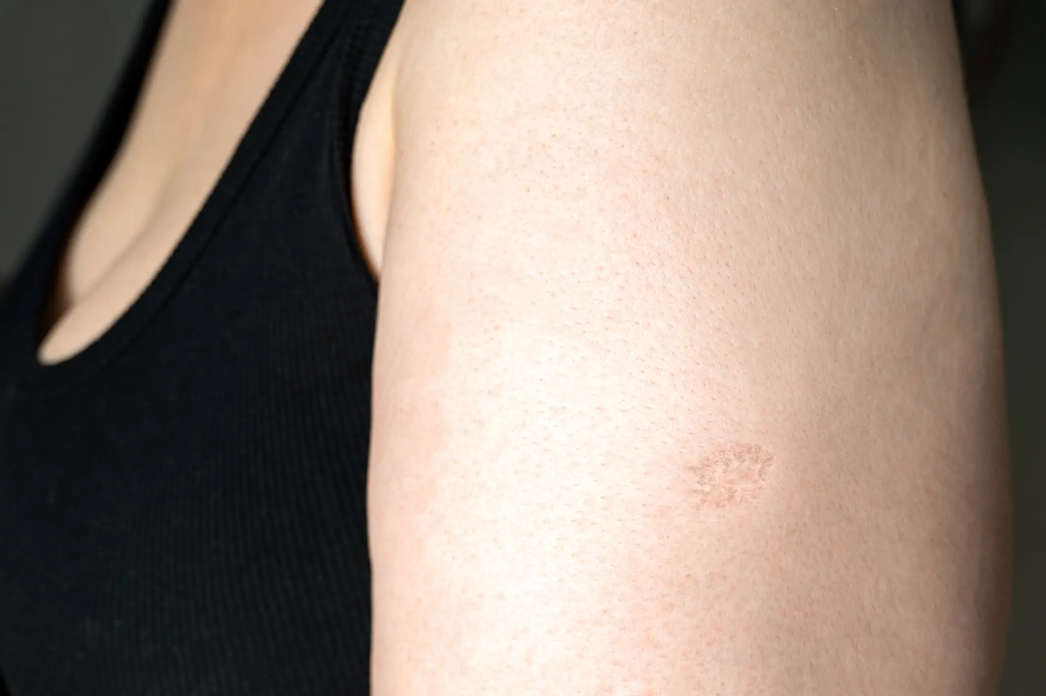 The mark is very distinctive (Getty Stock)