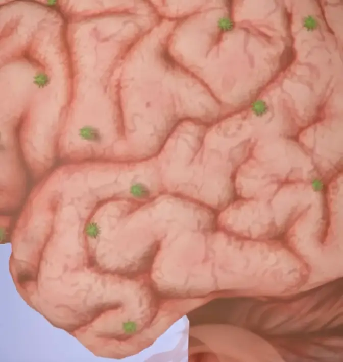 Doctors advice to trim, not pluck. (YouTube/@zackdfilms)