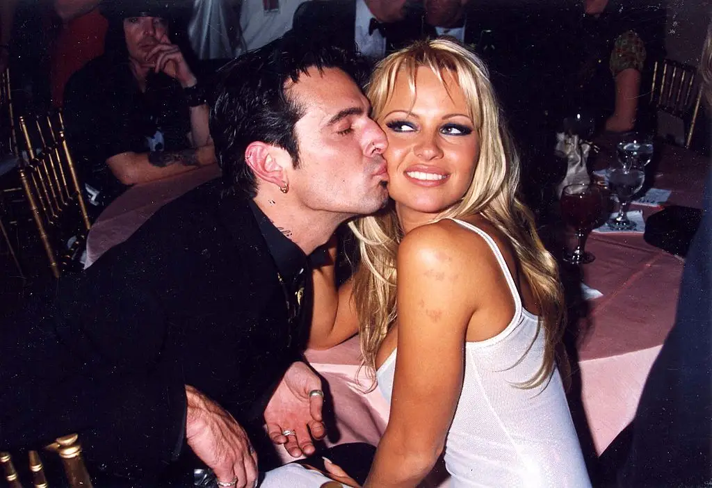Anderson previously revealed how she contracted the virus when she and ex-husband Tommy Lee shared a tattoo needle (Jeff Kravitz/FilmMagic, Inc)
