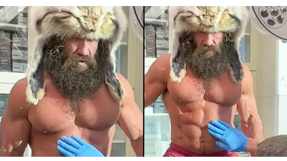 barrettplasticsurgery / TikTok