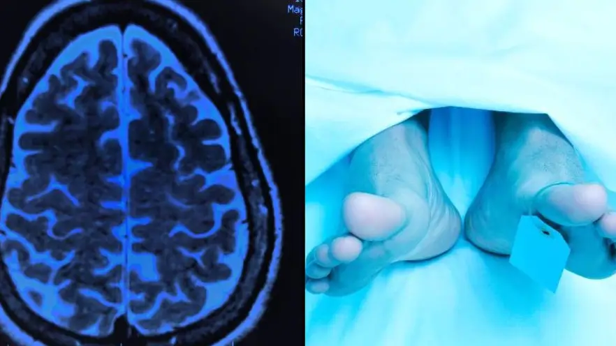 Study explains what you may see in final moments before death