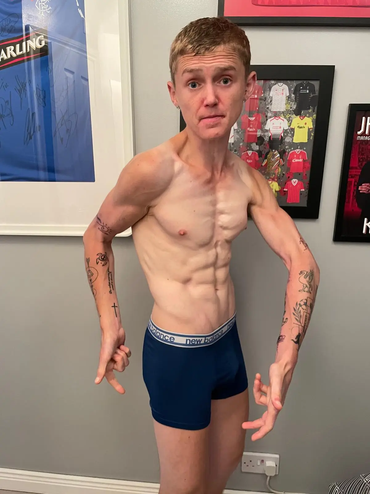 Jordan is now gaining muscle and is on his road to recovery (Jordan Caldwell)