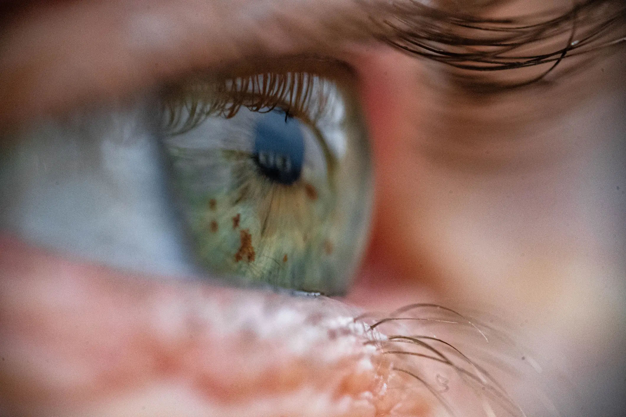 Participants with ADHD had more blood vessels, thicker vessels and smaller optic discs (Getty Stock Images)