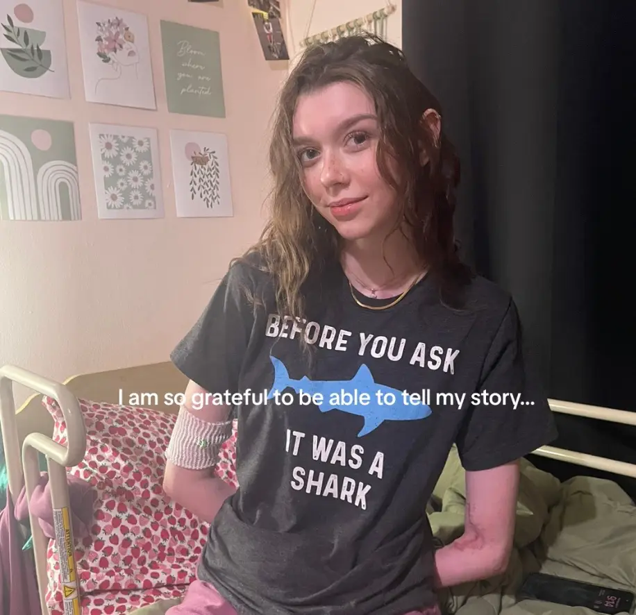 She hopes she can make a difference to other young amputees. (Instagram/@amalie.moira)