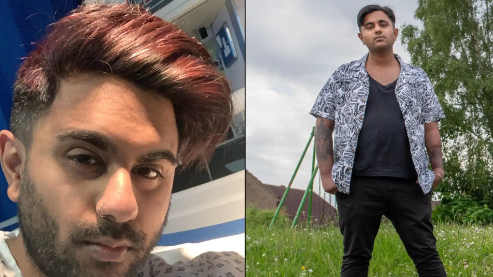 Man Born With Micro-Penis Says Sex Life Is Much 'Healthier' After Growing Replacement On His Arm