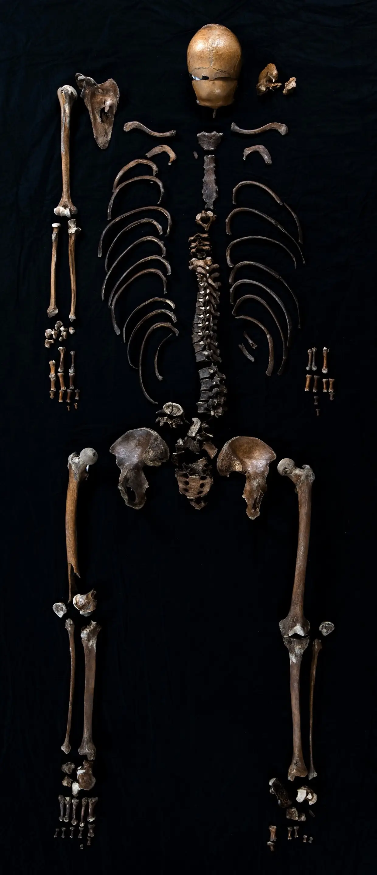 The 'Well Man' skeleton (Åge Hojem NTNU Vitenskapsmuseet)