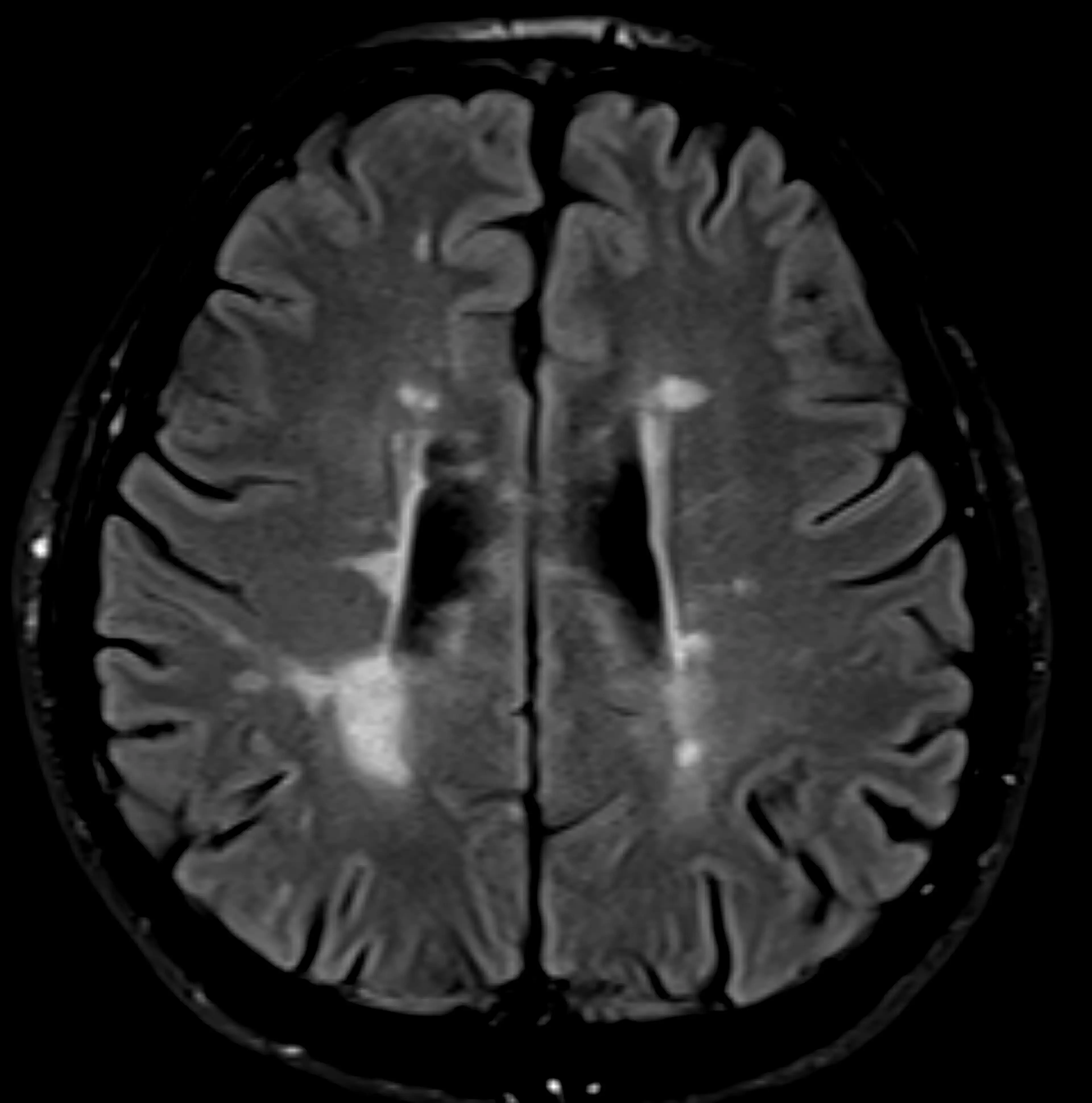 MS can affect you in numerous ways that go beyond physical aspects.