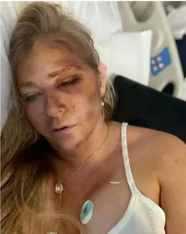 Giuffre said she only has 'four days to live' (Instagram/@virginiarobertsrising11)