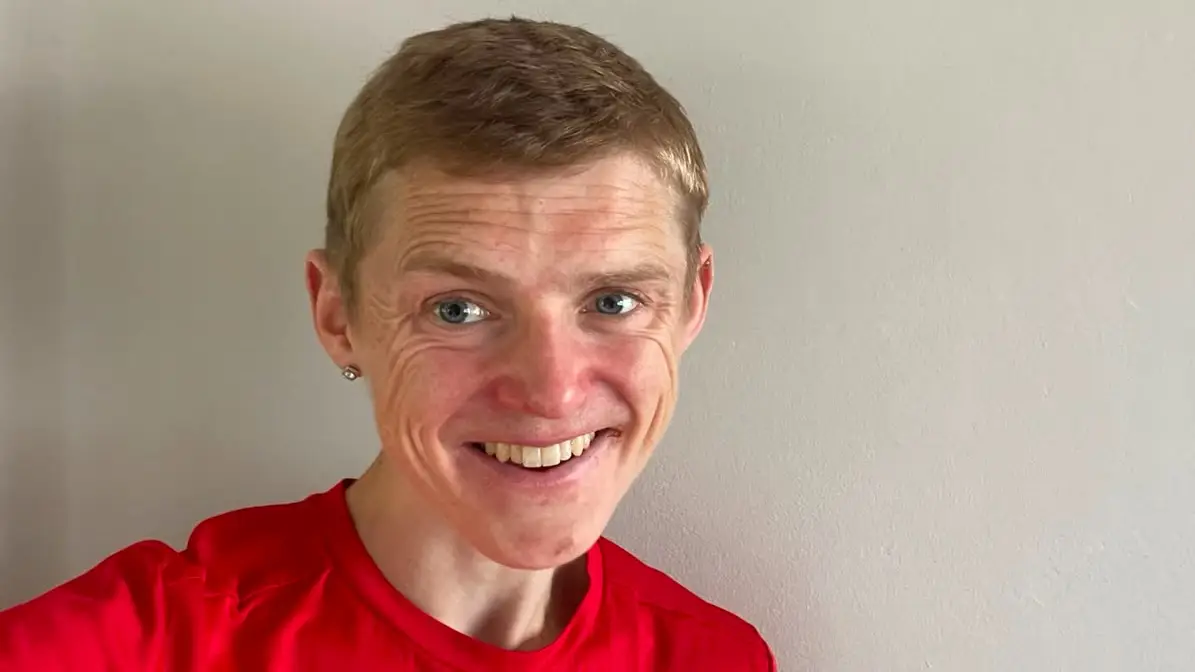 ‘You never really recover’ - Man shares transformation after anorexia nearly killed him