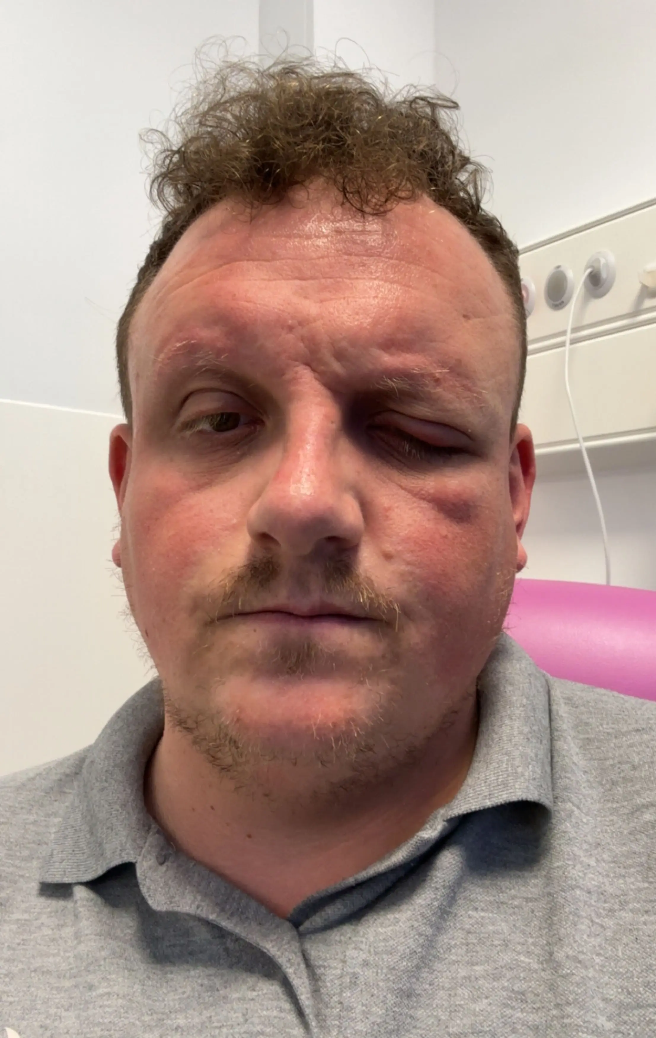 Jordan said he looked like Sloth from The Goonies (Kennedy News and Media)