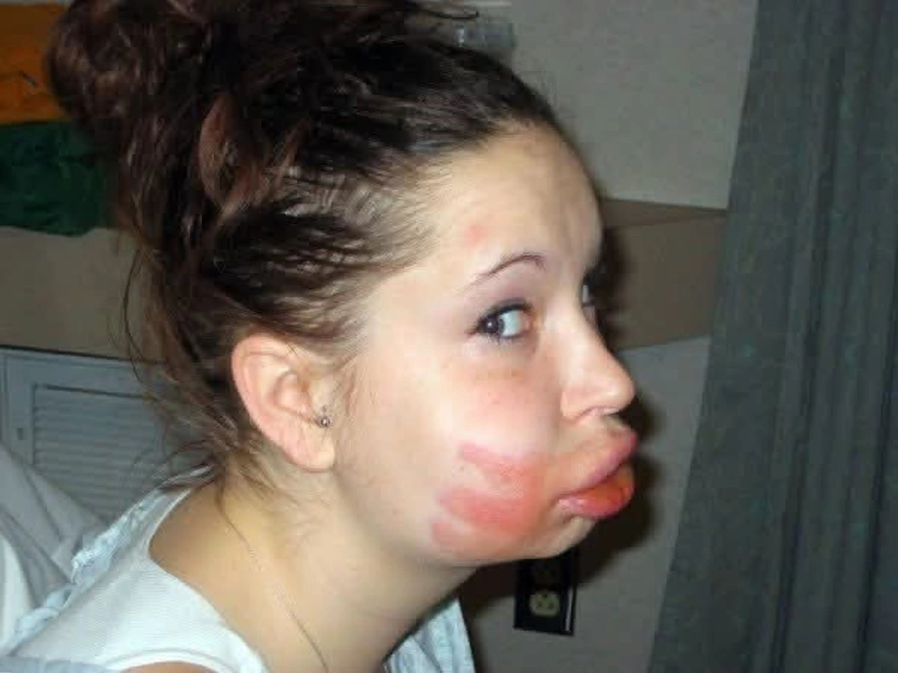 She was hospitalised with the injuries (Kennedy News and Media)