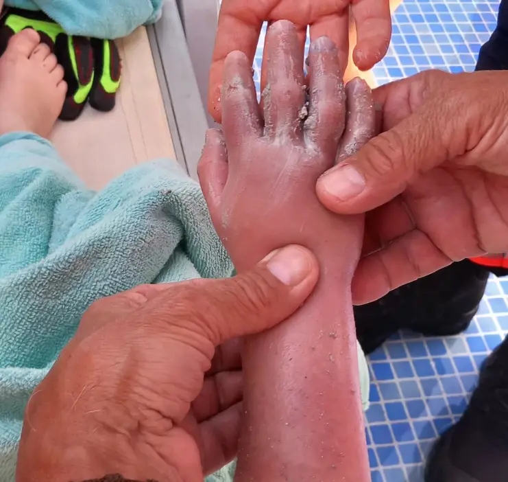 The boy was taken to hospital and checked over, fortunately he's not seriously injured (Bombers de Mallorca)