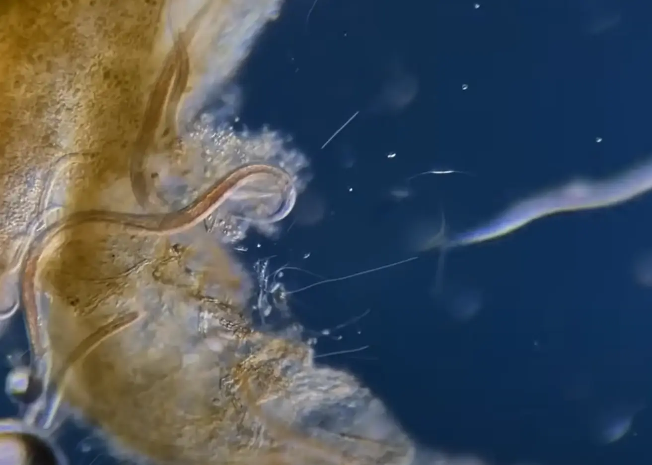 Look at the wriggling little worms. (YouTube/Picocosmos)