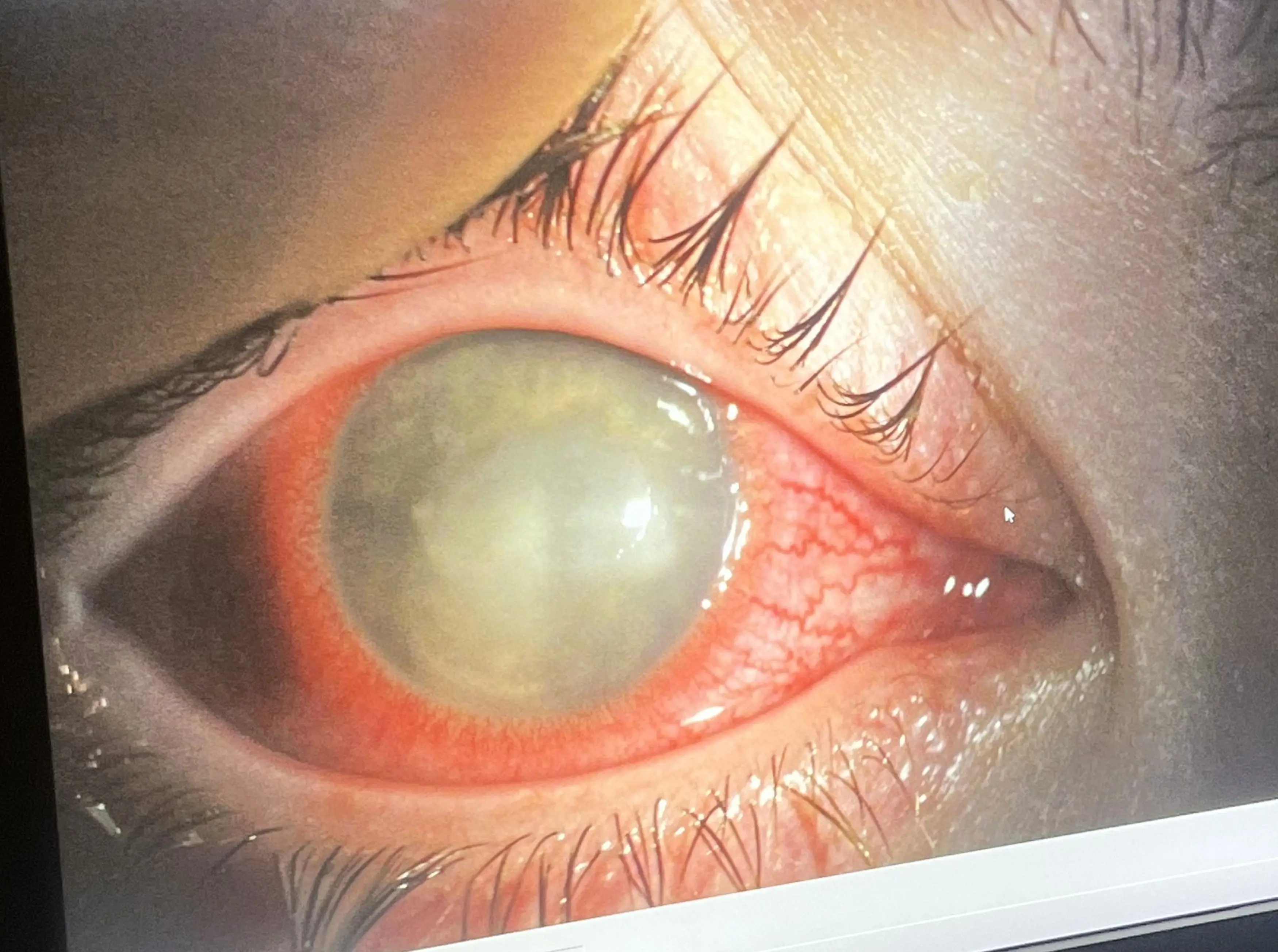 Brooklyn has a parasitic infection (Kennedy News and Media)