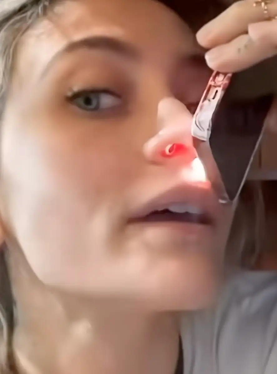 The model shared the condition her nose is in as a result of her past struggles with drugs (TikTok/@ParisJacksonBrazil)