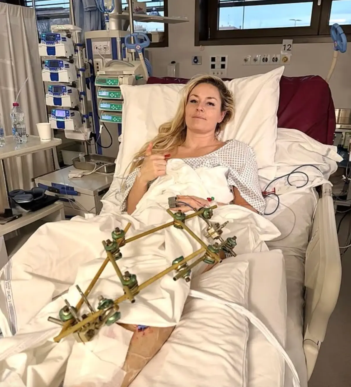 She broke her leg in the crash (Instagram/@lindseyvonn)