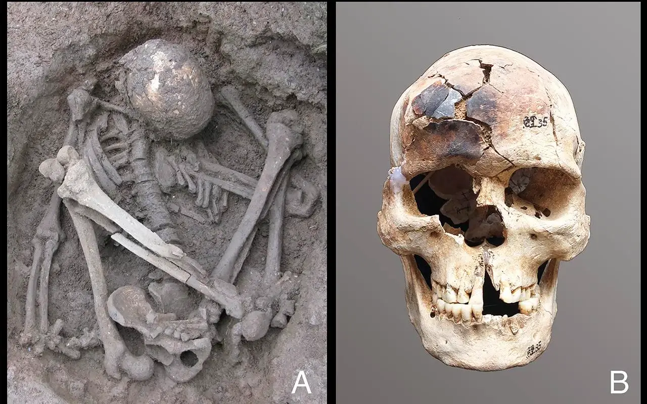 The mummies date as far back as 12,000 years. (H. Hung et al. Proc. Natl. Acad. Sci. U.S.A.)