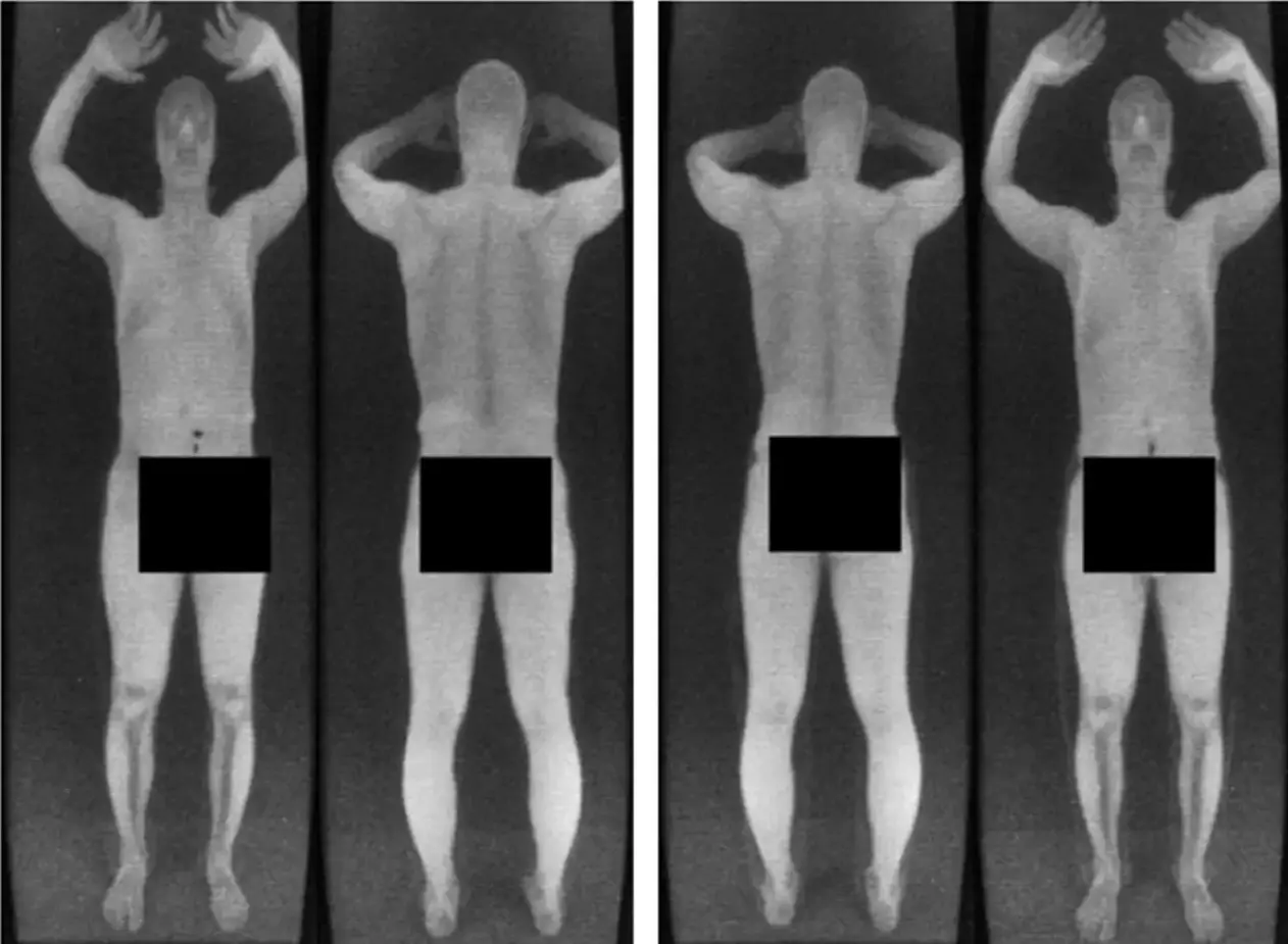 The scanners would previously show A LOT more than people were comfortable with.