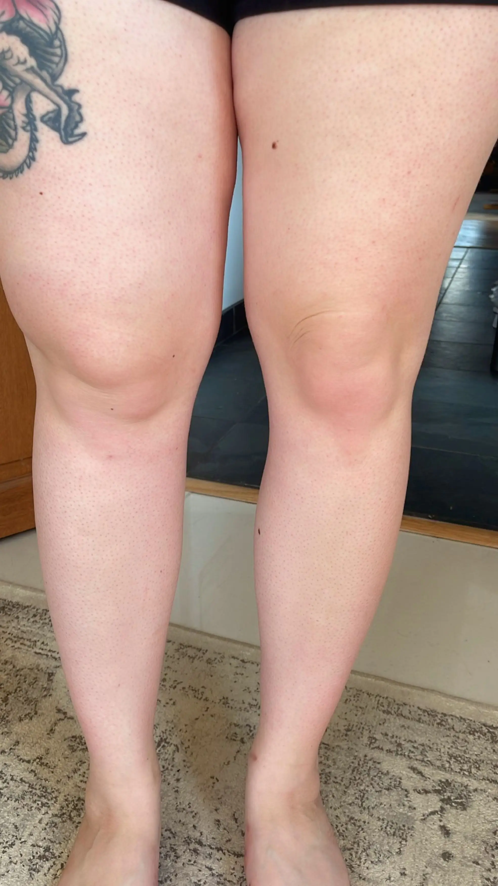 Lucy soon noticed a large lump was growing from her right knee (Kennedy News and Media)