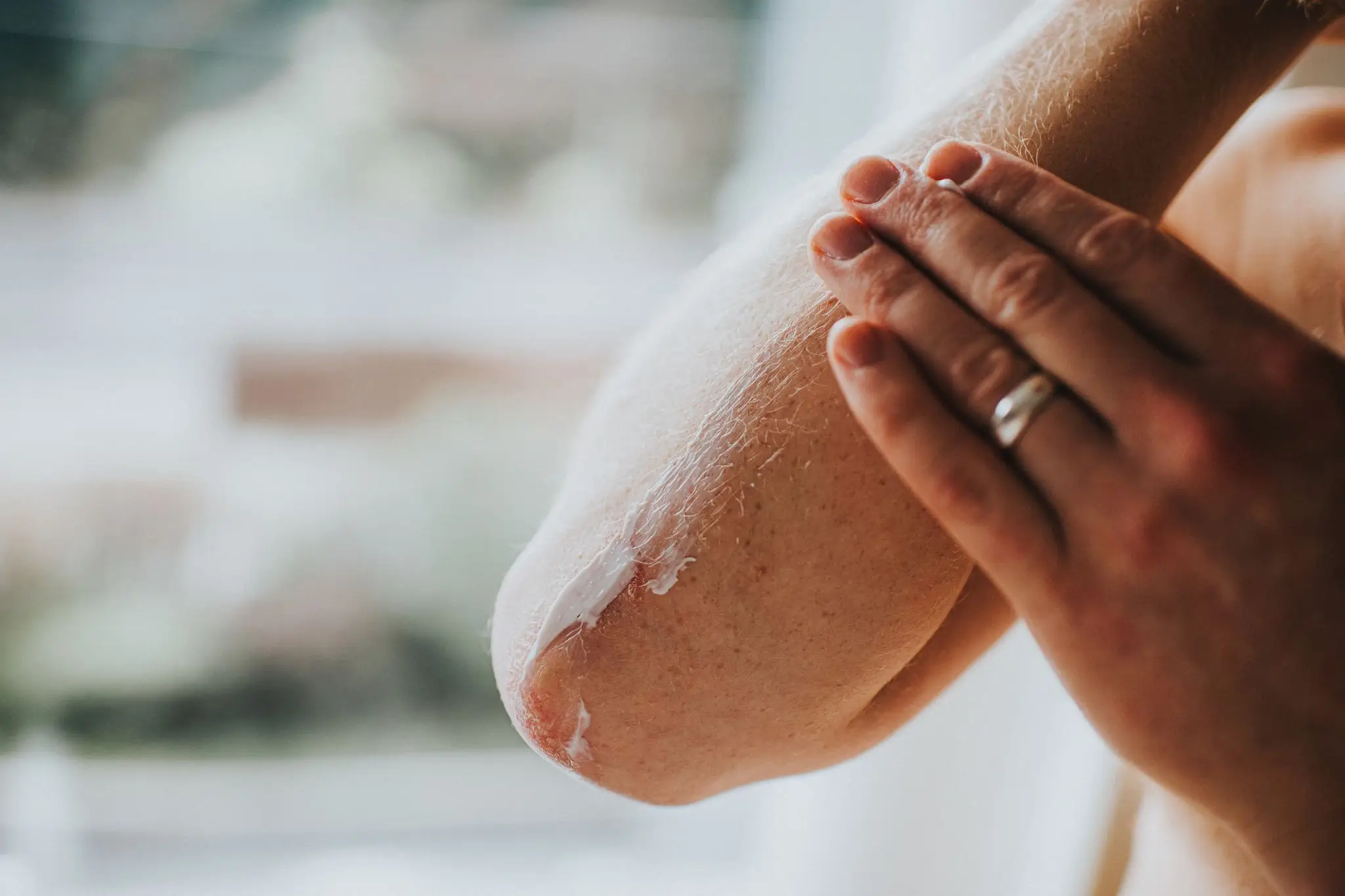 Maybe your dry skin isn't a weather issue. (Getty Stock Images) 