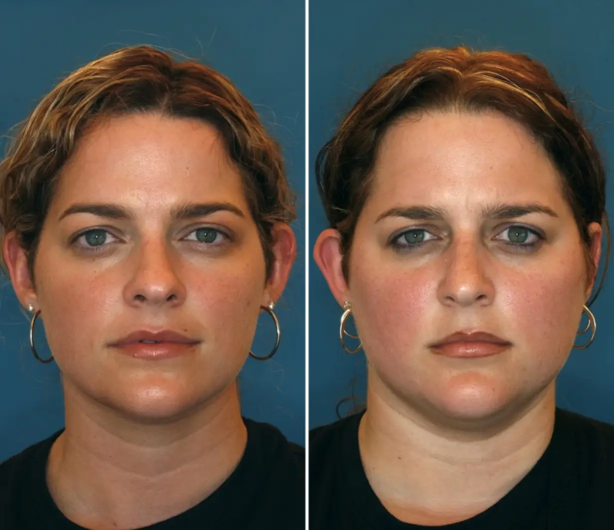 Dina and Gina, aged 27 (NBC)