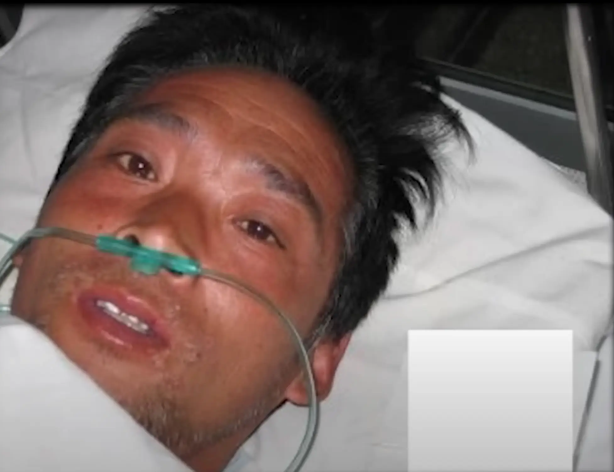 Ouchi had absorbed what is considered three times the fatal dose of radiation (Peaked Interest/YouTube)