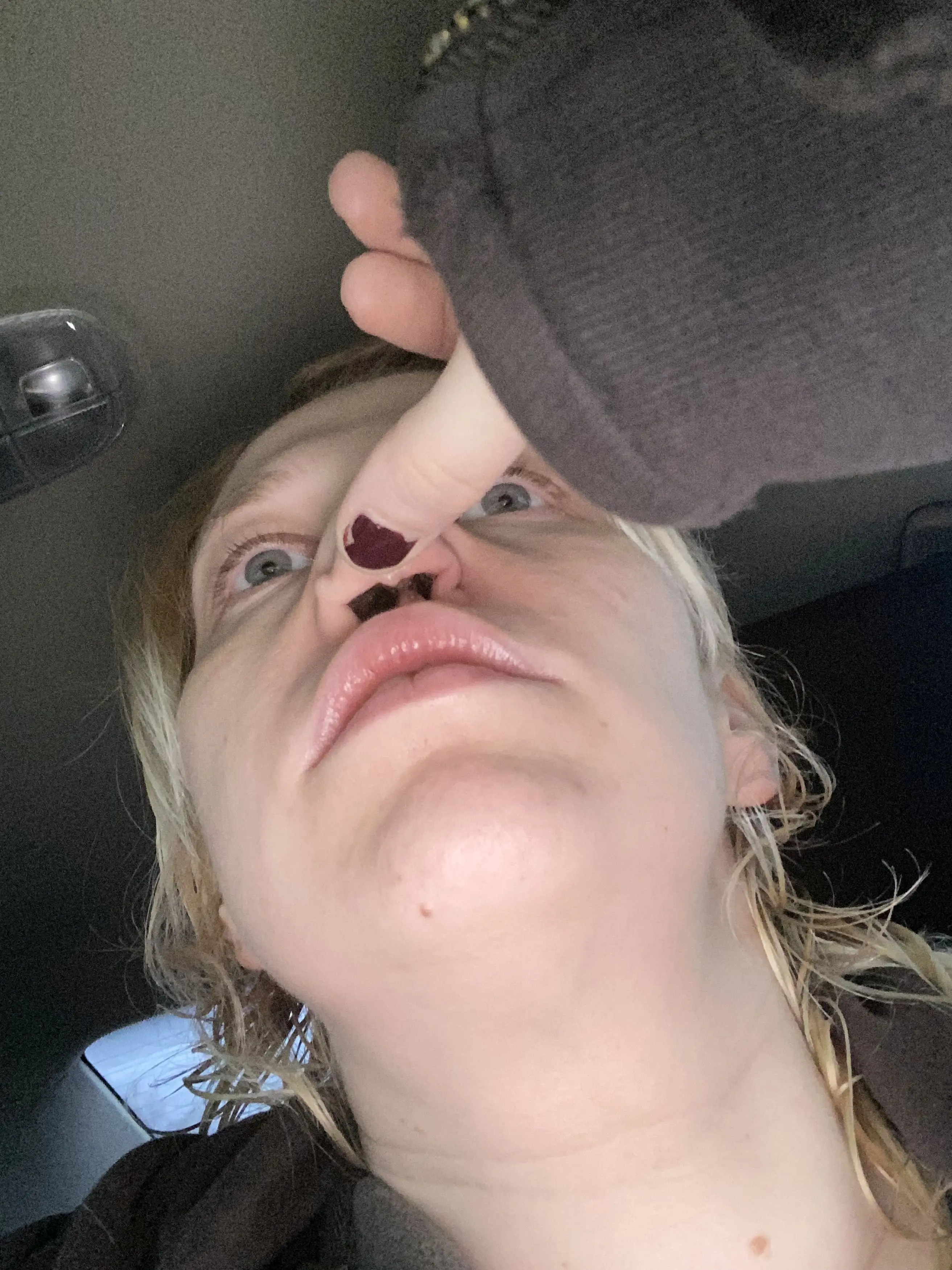 Kelly's drug habit ended up eroding her septum (Kennedy News and Media)