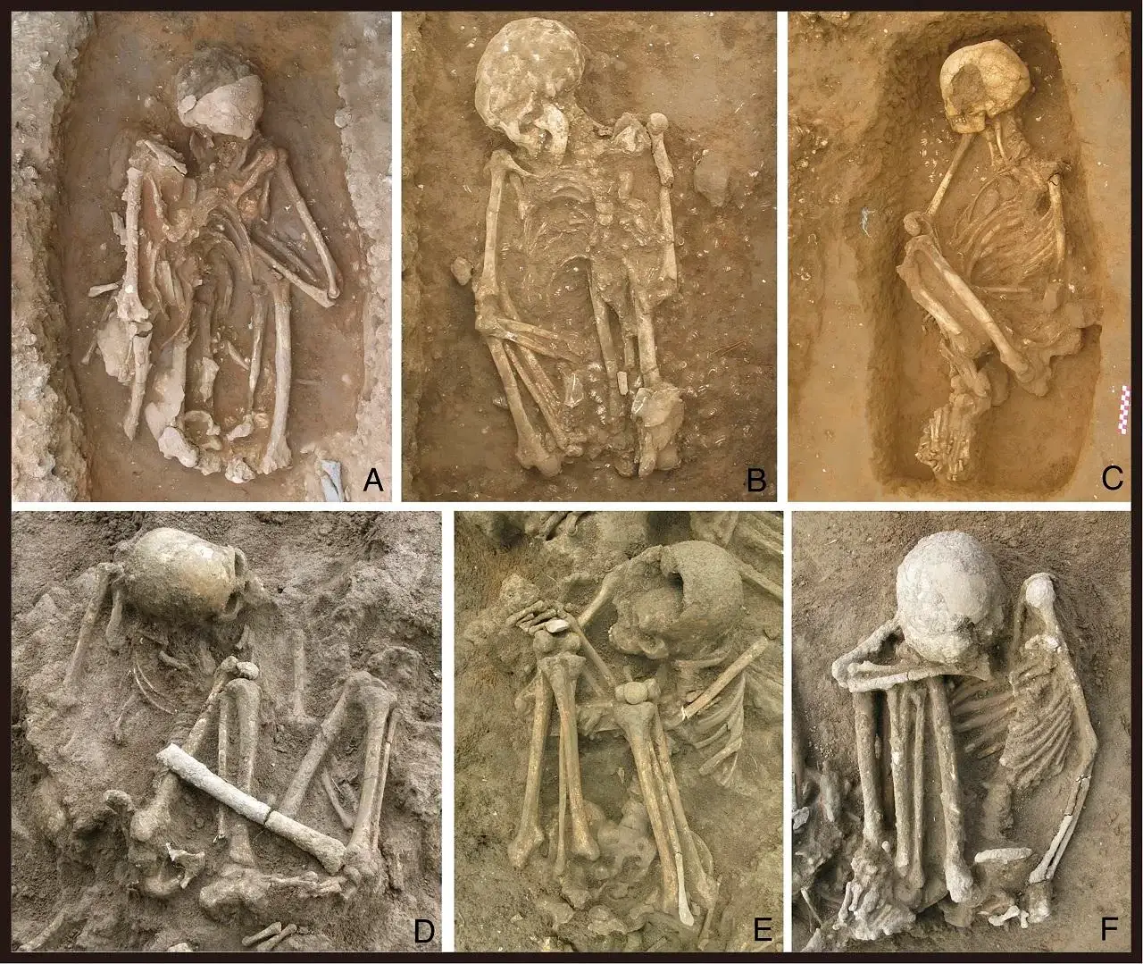It was revealed that several of the corpses had been smoke-dried above fires (H. Hung et al. Proc. Natl. Acad. Sci. U.S.A.)