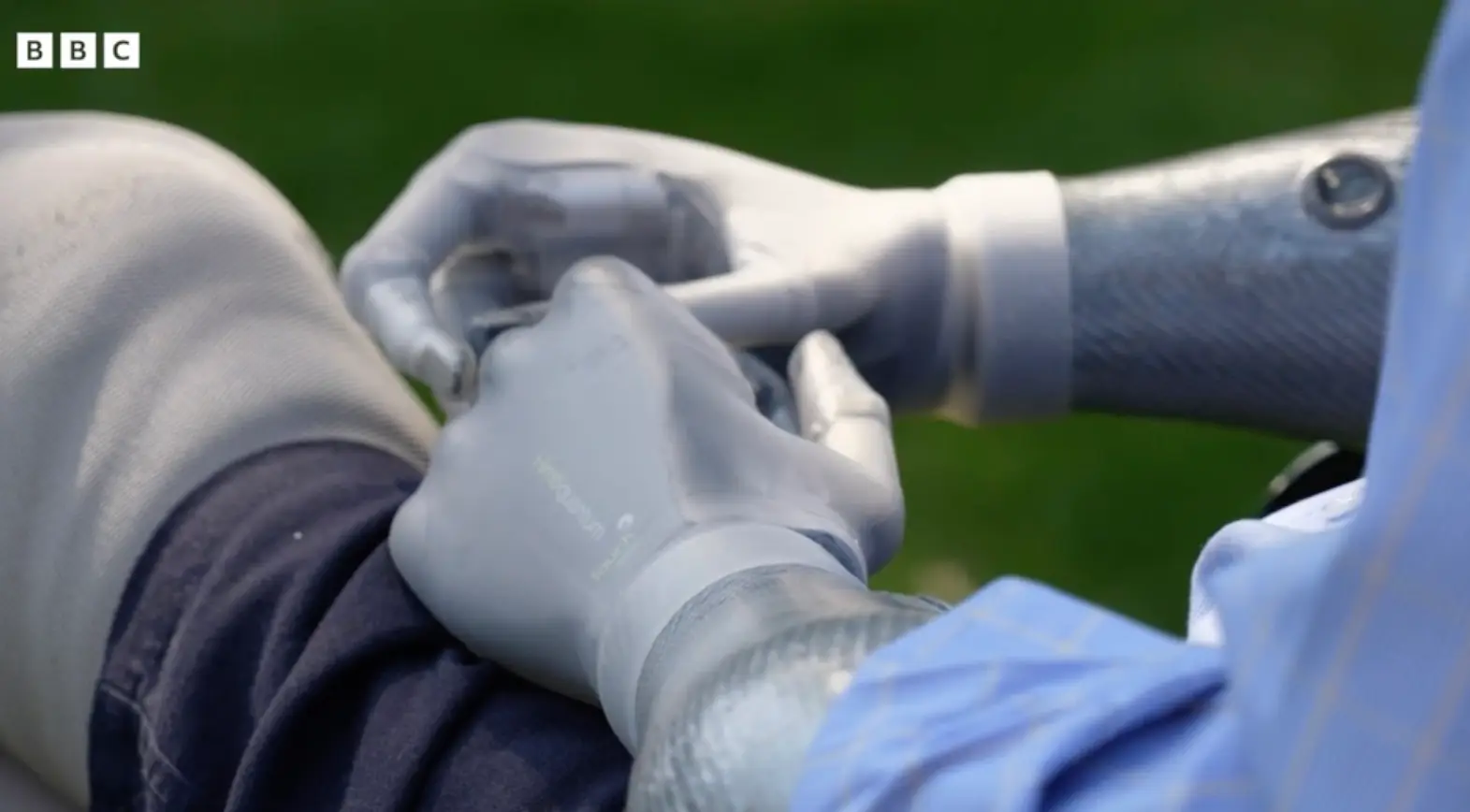 The dad wants to be known as Britain's first 'bionic' MP (BBC)