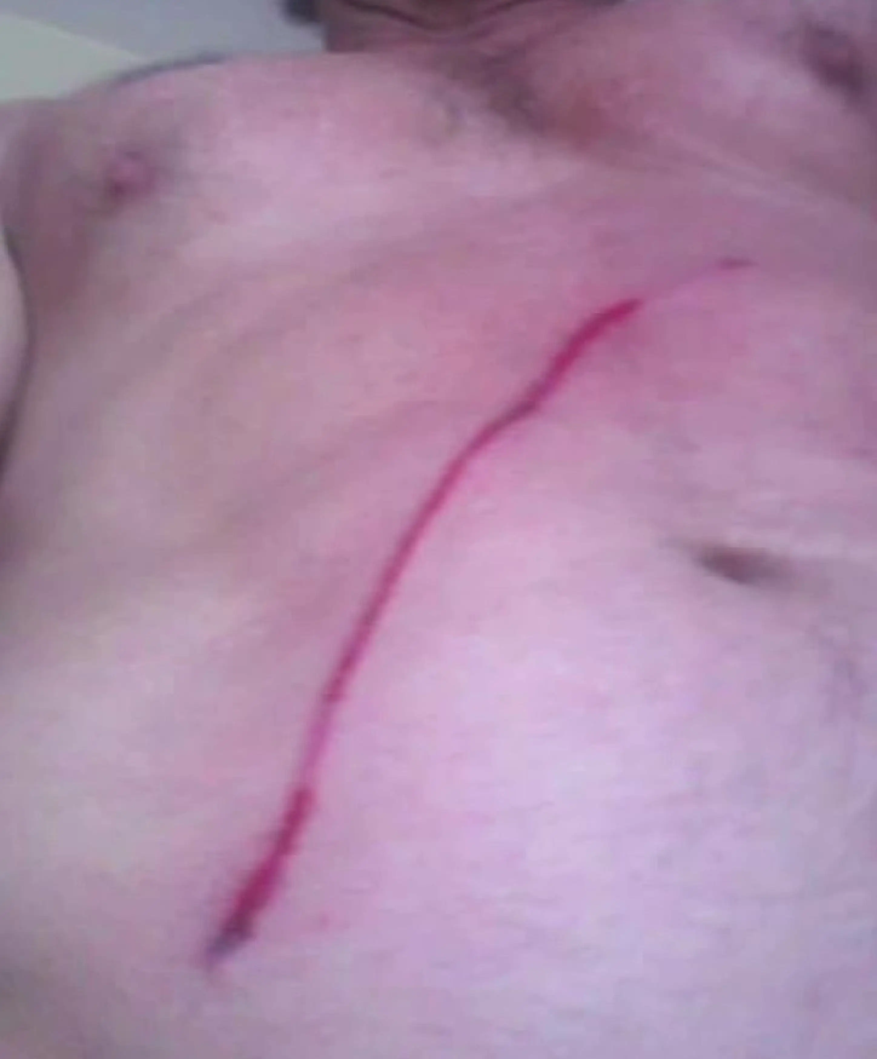 The animal's sharp claws cut through his stomach (Kennedy News and Media)