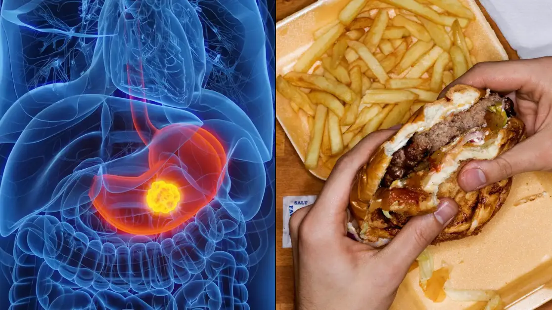 SEBASTIAN KAULITZKI/SCIENCE PHOTO LIBRARY/Getty Stock Image