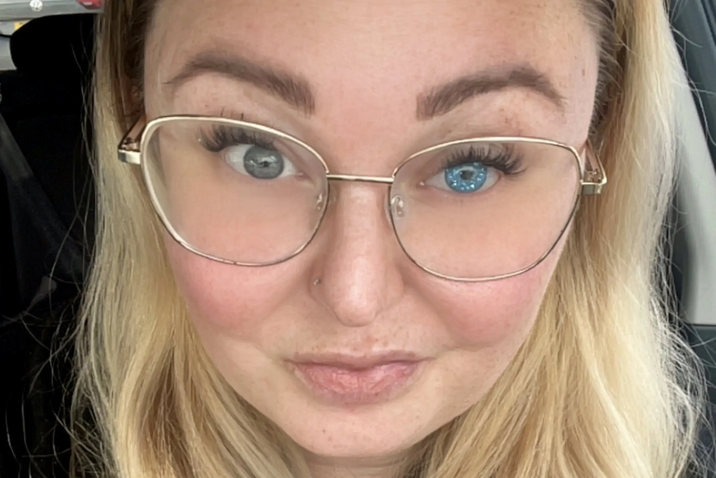 She's now got a glittery prosthetic eye, and says her daughter loves it (SWNS)