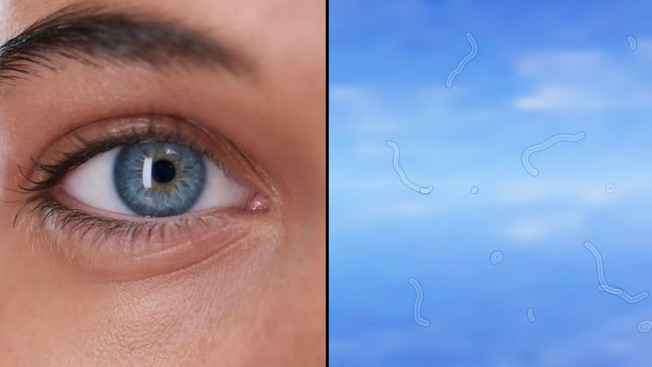 Expert explains what you should do if you start seeing these 'floaters' in your eyes