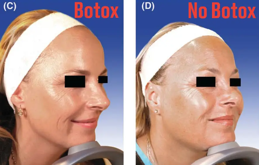 The twins lived in Munich and LA (American Society for Dermatologic Surgery)