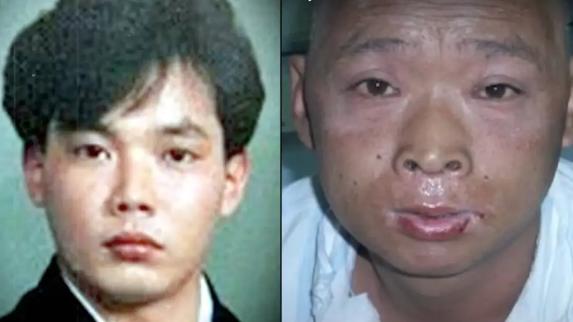 What happened to 'radioactive man' who suffered one of the most painful deaths ever recorded in human history