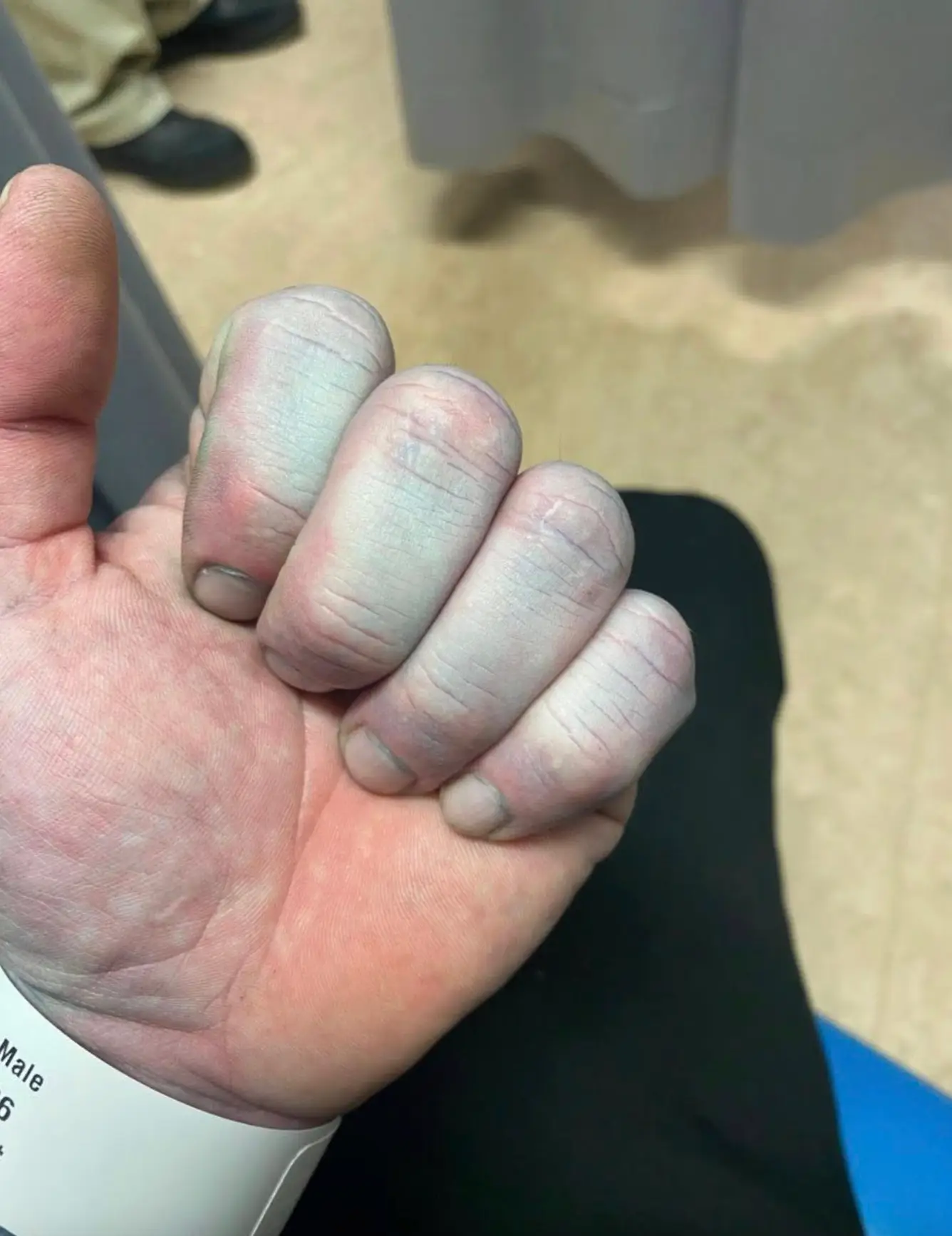 He has urged everyone to wash their bed sheets before using them (Facebook/Tommy Lynch)