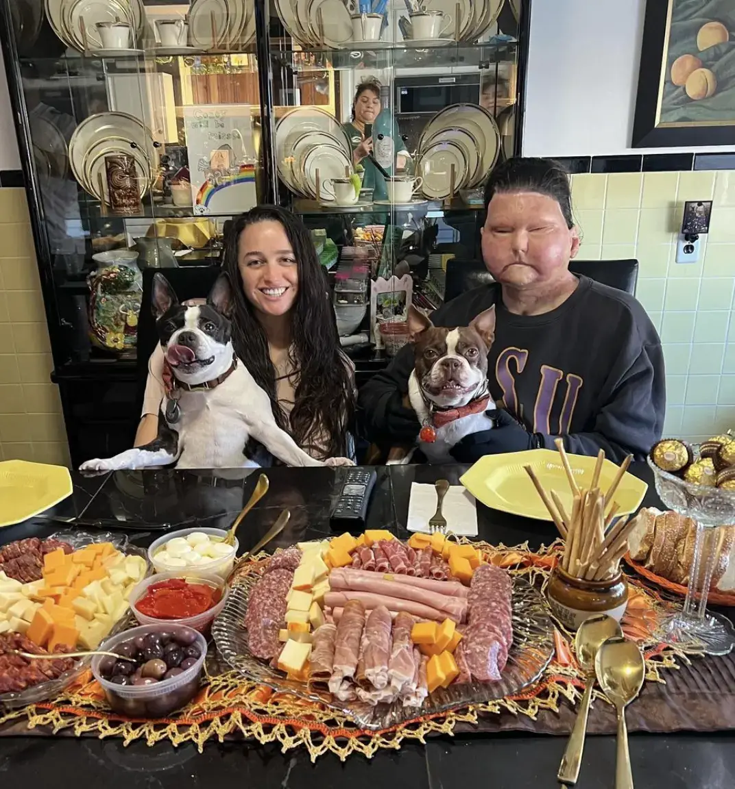 Joe DiMeo has found love since becoming the first person to successfully get a hands and face transplant, and it sounds like the wedding is soon. (Instagram/joeroydimeo)