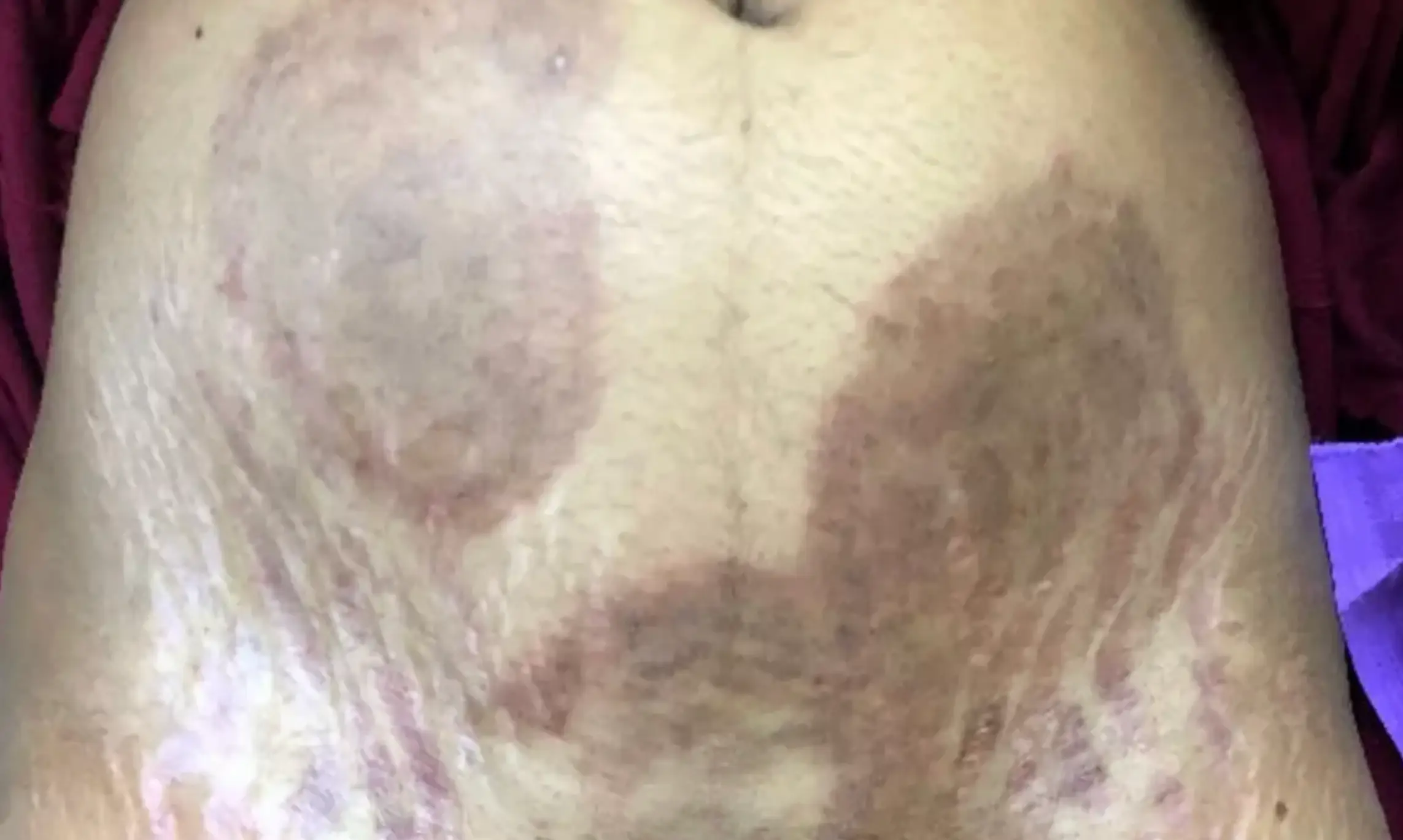 The condition is spreading across the UK at rates higher than ever before (MDPI)