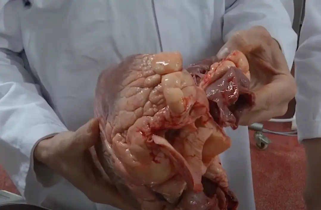 It only gets more gory from here.